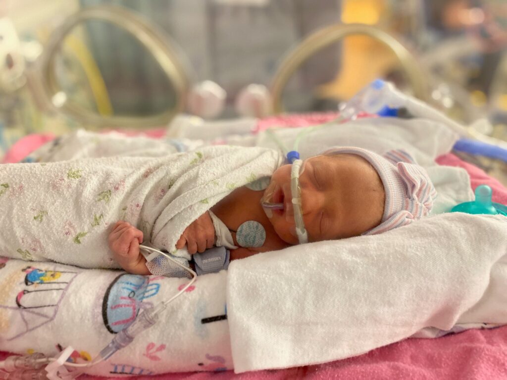 Lucy recovering in the NICU
