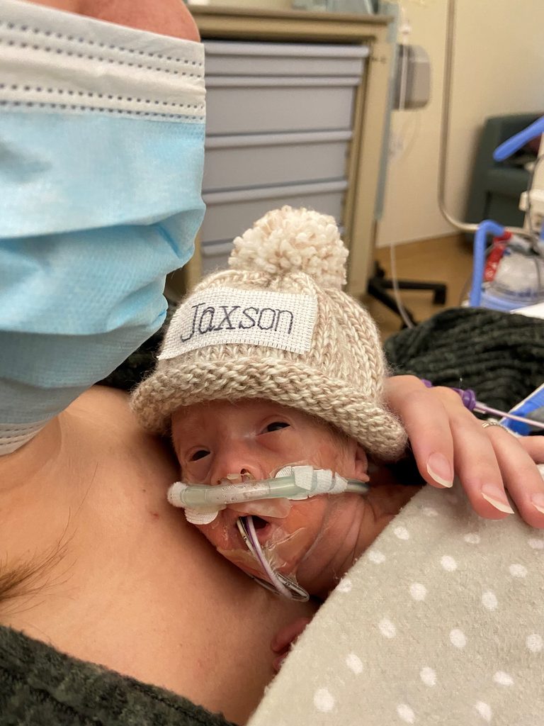 Alyssa Bruce holds her son Jaxson during his NICU stay