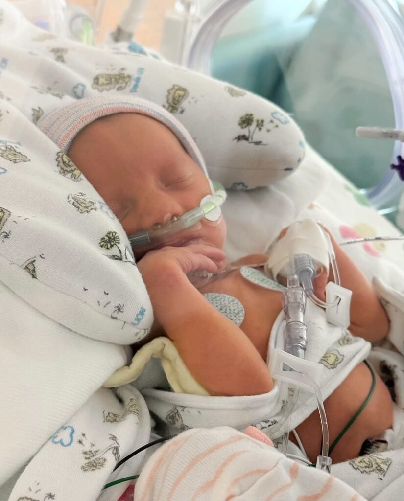 Sophie Stephens receives care in the NICU after being born at 31 weeks